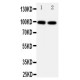 Ionotropic Glutamate receptor 2 Antibody