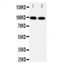 Ionotropic Glutamate receptor 2 Antibody