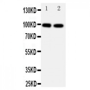 Ionotropic Glutamate receptor 2 Antibody