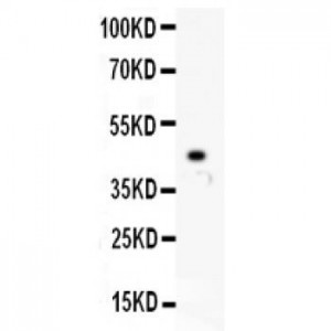 IP3 receptor  Antibody