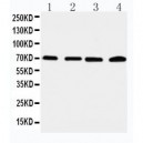 IRAK2 Antibody