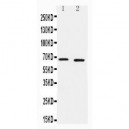 IRAKM Antibody