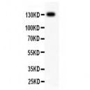 ITGB1  Antibody