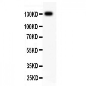 ITGB1  Antibody