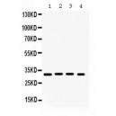 KChIP2  Antibody