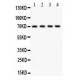 KCNMA1  Antibody