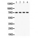 KCNMA1  Antibody