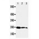 KGF Antibody