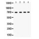 Ku70  Antibody