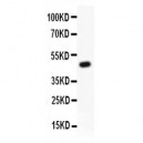 Kv2.1  Antibody