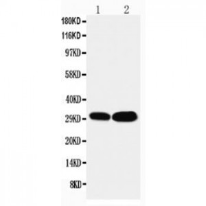 LASP1 Antibody