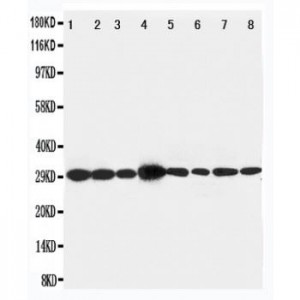 LASP1 Antibody