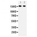 Leptin Receptor Antibody