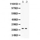 Lipocalin 2  Antibody