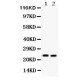 Lipocalin 2  Antibody