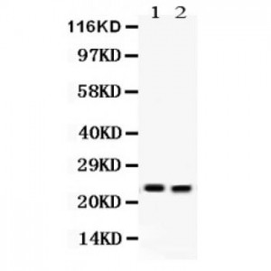 Lipocalin 2  Antibody