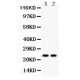 Lipocalin 2  Antibody