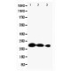 Lipocalin 2 Antibody