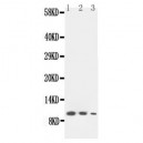 Lymphotactin Antibody