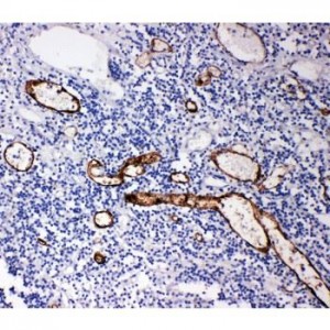 MAdCAM1 Antibody