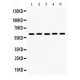 MAOA  Antibody