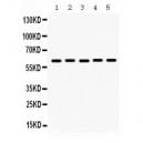 MAOA  Antibody