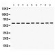 MAOB  Antibody