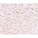 MAP1 Antibody (monoclonal)