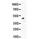 MCAK  Antibody
