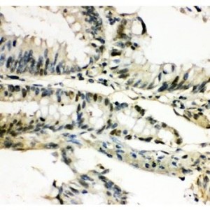 MEF2C Antibody