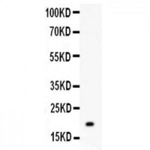 MGMT  Antibody