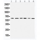 Mitochondrial Pyruvate dehydrogenase kinase 1 Antibody