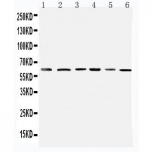 Mitochondrial Pyruvate dehydrogenase kinase 1 Antibody