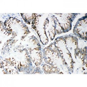 MMP14 Antibody