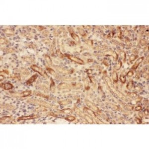 MMP7  Antibody