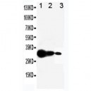 MMP7 Antibody