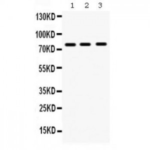 MMP9  Antibody