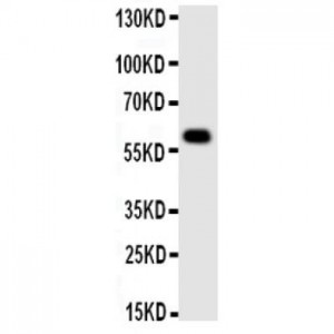 Monoamine Oxidase A Antibody