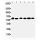 Monoamine Oxidase B Antibody