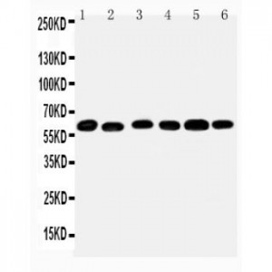 Monoamine Oxidase B Antibody