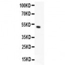 MSK1  Antibody