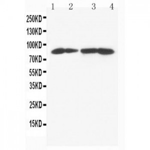 MTA1 Antibody