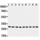 mtTFA Antibody