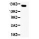 MUC1  Antibody