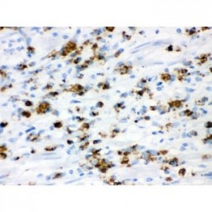 Mucin Gastric Antibody (monoclonal)