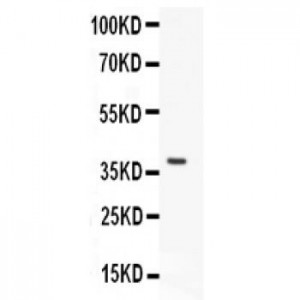 MUM1  Antibody