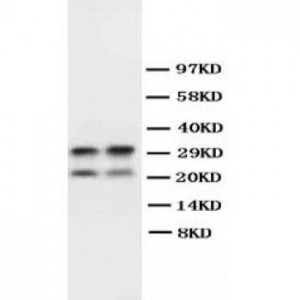 Myelin Basic Protein Antibody