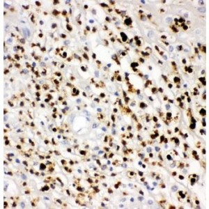 Myeloperoxidase  Antibody