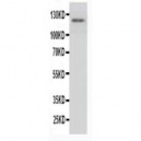 Myeloperoxidase Antibody