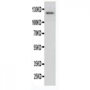 Myeloperoxidase Antibody